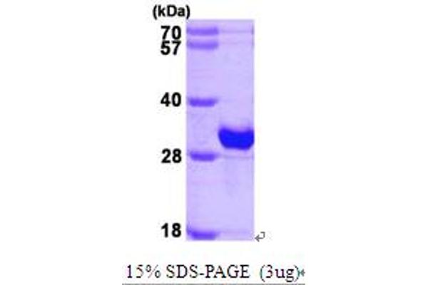 CRYBB1 Protein (AA 1-252) (His tag)