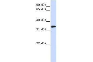WB Suggested Anti-MBD3 Antibody Titration:  0. (MBD3 antibody  (N-Term))