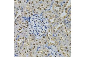 Immunohistochemistry of paraffin-embedded rat kidney using SQSTM1 Antibody. (SQSTM1 antibody)