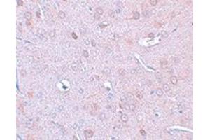 Immunohistochemical staining of rat brain tissue with DCLK1 polyclonal antibody  at 25 ug/mL dilution. (DCLK1 antibody  (N-Term))