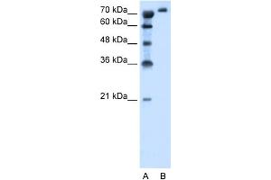 WB Suggested Anti-SLC6A18 Antibody Titration:  1.