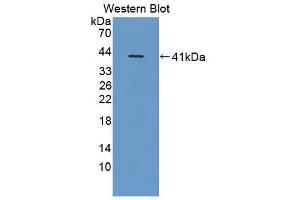 Detection of Recombinant CD14, Porcine using Polyclonal Antibody to Cluster Of Differentiation 14 (CD14) (CD14 antibody  (AA 21-373))