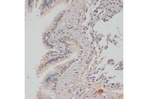 Immunohistochemistry of paraffin-embedded rat lung using Phospho-PPP1CA-T320 antibody (ABIN7269674) at dilution of 1:100 (40x lens). (PPP1CA antibody  (pThr320))