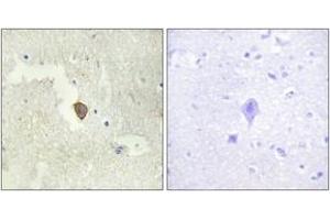 Immunohistochemistry analysis of paraffin-embedded human brain tissue, using ADCY7 Antibody.