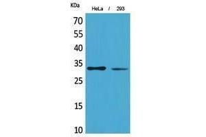 Western Blotting (WB) image for anti-Succinate Dehydrogenase Complex, Subunit B, Iron Sulfur (Ip) (SDHB) (Internal Region) antibody (ABIN3187945) (SDHB antibody  (Internal Region))