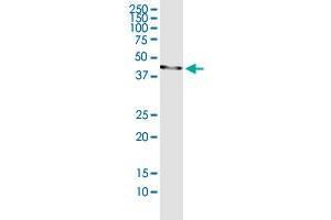 Immunoprecipitation (IP) image for ERCC8 (Human) IP-WB Antibody Pair (ABIN2752014)