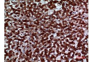 Immunohistochemistry (IHC) analysis of paraffin-embedded Human Liver, antibody was diluted at 1:100. (FMO3 antibody  (Internal Region))