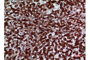Immunohistochemistry (IHC) analysis of paraffin-embedded Human Liver, antibody was diluted at 1:100.
