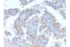 Immunohistochemistry (IHC) image for anti-Ret Proto-Oncogene (RET) (AA 702-848) antibody (ABIN6940506)