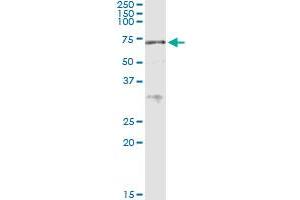 Immunoprecipitation of ACD transfected lysate using anti-ACD MaxPab rabbit polyclonal antibody and Protein A Magnetic Bead , and immunoblotted with ACD purified MaxPab mouse polyclonal antibody (B01P) . (ACD antibody  (AA 1-544))