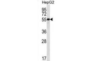 Western Blotting (WB) image for anti-UDP-Glucose 6-Dehydrogenase (UGDH) antibody (ABIN2996851) (UGDH antibody)