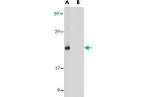 Western blot analysis of DIABLO in human heart tissue lysate in the absence (A) or presence (B) of blocking peptide with DIABLO polyclonal antibody  at 1 ug /mL . (DIABLO antibody  (AA 225-239))