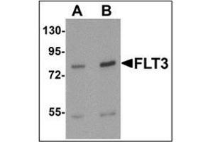 Western blot analysis of FLT3 in 3T3 cell lysate with FLT3 antibody at (A) 1 and (B)2 ug/mL.