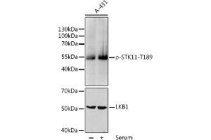 Western blot analysis of extracts of HeLa cells, using Phospho-STK11-T189 pAb (ABIN6135324, ABIN6136264, ABIN6136265 and ABIN6225621) at 1:1000 dilution or LKB1 antibody (ABIN3022972, ABIN3022973, ABIN3022974, ABIN1512838 and ABIN6219324). (LKB1 antibody  (pThr189))