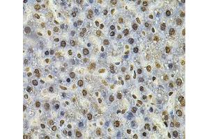 Immunohistochemistry (Paraffin-embedded Sections) (IHC (p)) image for anti-Interferon, gamma-Inducible Protein 16 (IFI16) antibody (ABIN7257561)