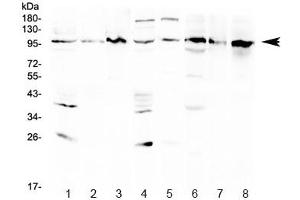 Western blot testing of 1) rat brain, 2) rat kidney, 3) rat NRK, 4) mouse brain, 5) mouse kidney, 6) human HeLa, 7) human Jurkat and 8) human K562 lysate with AGO1 antibody at 0. (AGO1 antibody  (AA 376-409))