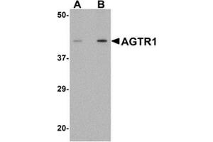 Western blot analysis of AGTR1 in mouse kidney tissue lysate with AGTR1 antibody at (A) 1 and (B) 2 μg/ml. (Angiotensin II Type-1 Receptor antibody  (Center))
