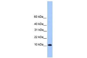 TRAPPC6B antibody used at 1 ug/ml to detect target protein. (TRAPPC6B antibody  (Middle Region))