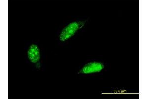 Immunofluorescence of monoclonal antibody to PCNA on HeLa cell. (PCNA antibody  (AA 152-261))