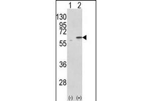Western blot analysis of PDIA3 (arrow) using rabbit polyclonal PDIA3 Antibody (C-term) (ABIN389464 and ABIN2839529). (PDIA3 antibody  (C-Term))