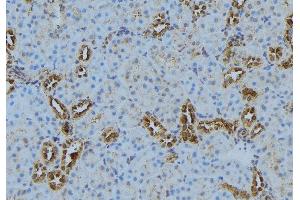 ABIN6272877 at 1/100 staining Mouse kidney tissue by IHC-P. (LPCAT1 antibody  (Internal Region))