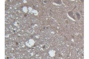 #VALUE! (GLRa2 antibody  (AA 28-253))