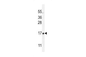 C Antibody (C-term) (ABIN654737 and ABIN2844424) western blot analysis in MDA-M cell line lysates (35 μg/lane). (CFAP410 antibody  (C-Term))