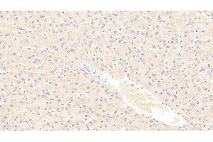 Detection of TUBa3C in Human Liver Tissue using Polyclonal Antibody to Tubulin Alpha 3C (TUBa3C) (TUBA3C antibody  (AA 1-300))