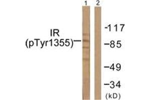 Western blot analysis of extracts from 293 cells treated with Heat shock, using IR (Phospho-Tyr1355) Antibody. (IR (AA 1326-1375), (pTyr1355) antibody)