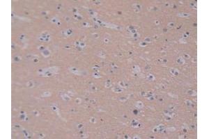 IHC-P analysis of Human Brain Tissue, with DAB staining. (PEBP1 antibody  (AA 2-187))