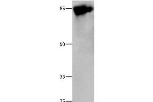 Western Blot analysis of 293T cell using Caldesmon Polyclonal Antibody at dilution of 1:800 (Caldesmon antibody)