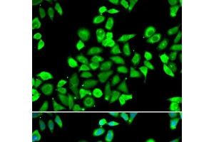 CDC16 antibody