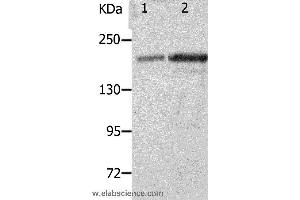 Western blot analysis of Mouse spleen and kidney tissue, using NPHS1 Polyclonal Antibody at dilution of 1:800