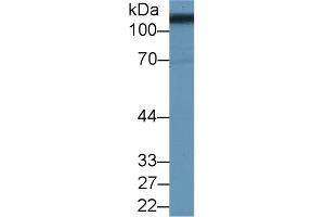 Detection of SLC3A2 in Porcine Kidney lysate using Polyclonal Antibody to Solute Carrier Family 3, Member 2 (SLC3A2) (SLC3A2 antibody  (AA 213-349))