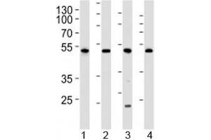 Western blot analysis of lysate from 1) human 293, 2) mouse NIH3T3, 3) rat C6 cell line and 4) mouse kidney tissue lysate using Cdk9 antibody at 1:1000. (CDK9 antibody  (AA 251-278))