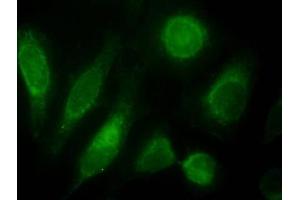 Immunofluorescence testing of HeLa cells with ODZ3 antibody at 10ug/ml [green] shows staining of nuclei. (TENM3 antibody)