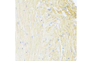 Immunohistochemistry of paraffin-embedded mouse heart using UQCC2 antibody  at dilution of 1:100 (40x lens). (MNF1 antibody  (AA 14-126))