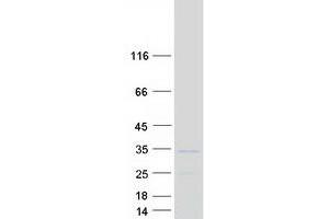 Western Blotting (WB) image for Ribosomal Protein L8 (RPL8) (Transcript Variant 1) protein (Myc-DYKDDDDK Tag) (ABIN2731151)