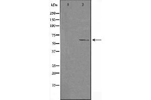 Western blot analysis of extracts from HeLa cells, using Cytochrome P450 4F11 antibody.