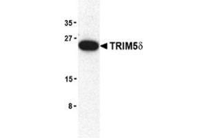 Western blot analysis of TRIM5 delta expression in mouse brain cell lysate with TRAP30953PU-N at 2 μg/ml. (TRIM5 antibody  (C-Term, Isoform delta))