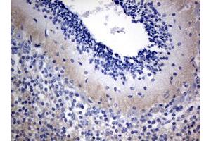 Image no. 1 for anti-Visinin-Like 1 (VSNL1) (AA 2-191) antibody (ABIN1491120) (VSNL1 antibody  (AA 2-191))