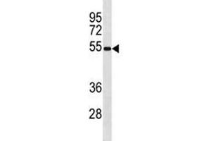 Ips-1 antibody western blot analysis in mouse spleen tissue lysate. (MAVS antibody  (AA 1-30))
