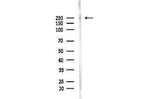 Western blot analysis of lysates from Mouse brain, using JMJB Antibody at 1/1000 dilution.