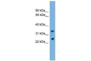 CHMP4B antibody used at 0. (CHMP4B antibody  (Middle Region))
