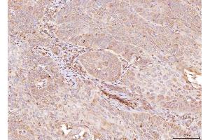 IHC analysis of NDUFB8 using anti-NDUFB8 antibody (ABIN7599048).