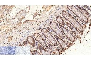 Immunohistochemistry of paraffin-embedded Human colon tissue using GAPDH Monoclonal Antibody at dilution of 1:200. (GAPDH antibody)