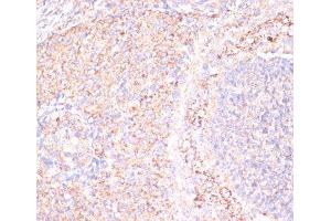 Immunohistochemistry of paraffin-embedded Rat ovary using ATP5A1 Polyclonal Antibody at dilution of 1:100 (40x lens). (ATP5A1 antibody)