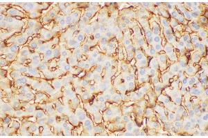 Immunohistochemistry of paraffin-embedded Mouse liver using FGB Polycloanl Antibody at dilution of 1:200 (Fibrinogen beta Chain antibody)