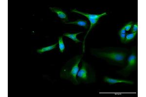 Immunofluorescence of purified MaxPab antibody to OXA1L on HeLa cell. (OXA1L antibody  (AA 1-435))