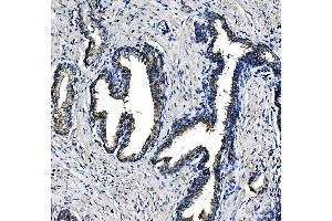 IHC analysis of PCK2 using anti-PCK2 antibody (ABIN7599509).